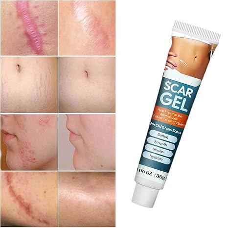 Silicone Scar Removal Gel - Skincare Treatment Designed For Scar Care And Smooth Skin