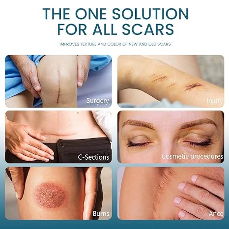 Silicone Scar Removal Gel - Skincare Treatment Designed For Scar Care And Smooth Skin